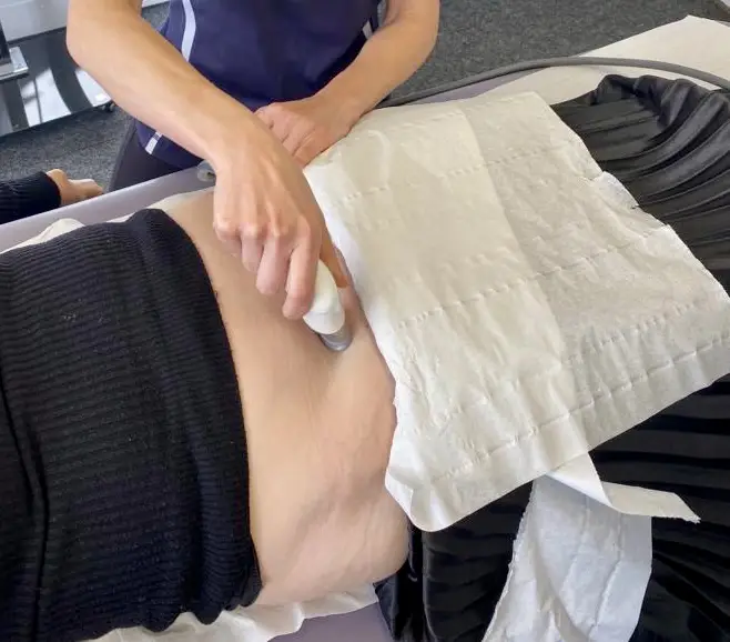 Minimising C-Section Scarring
